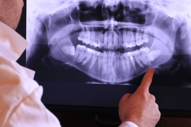 Best Orthodontic Emergency Dentist in Moss Bluff, LA