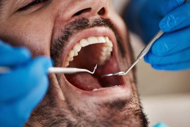 Best Weekend Emergency Dentist in Moss Bluff, LA