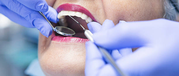 Best Emergency Dental Care for Abscessed Tooth in Moss Bluff, LA